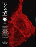 Science Journal: Blood - The American Society of Hematology